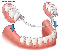 Flap & Gum Surgeries